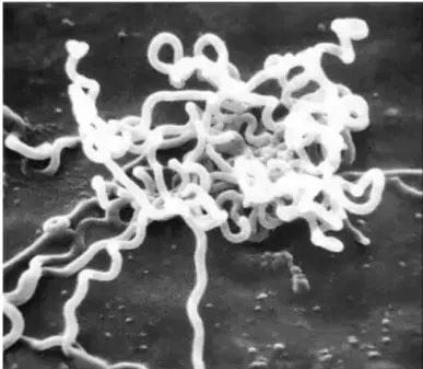 Micrografía de la bacteria Treponema pallidum, espiroqueta de forma helicoidal característica de la sífilis.