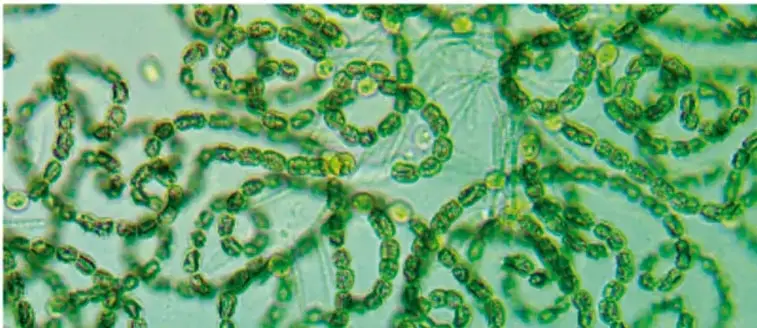 Micrografía de células verdes alargadas, probablemente algas filamentosas, observadas al microscopio.