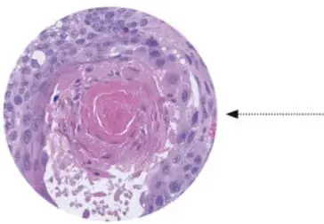 Micrografía de células vegetales o algas con cloroplastos verdes.