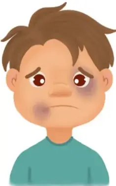 Ilustración de un niño con un moretón en el ojo y expresión triste, con la leyenda 'María José Salas González, JALISCO'.