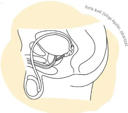 Ilustración de un modelo del aparato reproductor masculino con mangueras y jeringa.