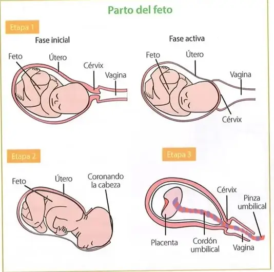 Esquema ilustrado de las fases del parto: fase inicial, fase activa, nacimiento del bebé y expulsión de la placenta.