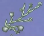 Ilustración de Candida albicans bajo el rótulo de infecciones micóticas.