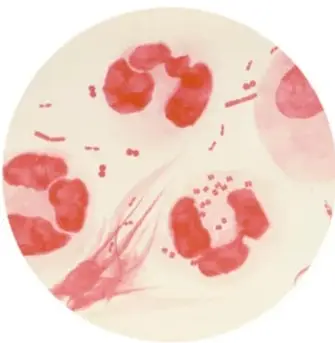 Fotografía microscópica de células teñidas (prueba de clamidiasis)