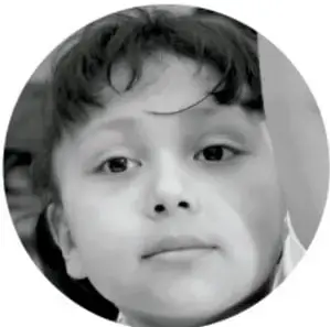 Fotografía en blanco y negro del rostro de un niño.
