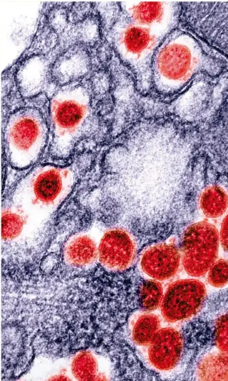 Microfotografía (microscopía electrónica) de estructuras celulares con partículas virales o bacterias teñidas de rojo sobre un fondo azul-grisáceo, vinculada a la observación de bacterias, células y virus mencionada en los horizontes de expectativas.