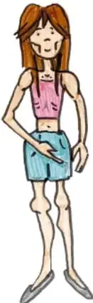 Ilustración de una chica delgada con signos de desnutrición.
