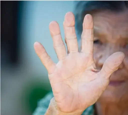 Fotografía de una persona mayor mostrando la palma de la mano abierta hacia la cámara.
