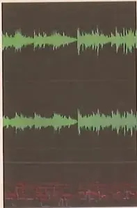 Imagen de una onda de sonido de radio representada como una señal de audio.