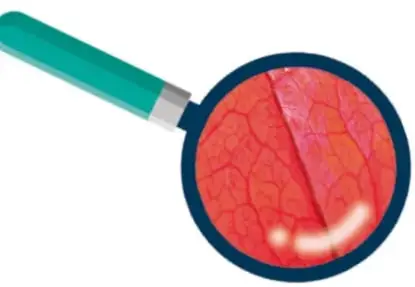 Icono de una lupa con una hoja vegetal rojiza vista de cerca, sugiriendo la observación microscópica de tejido vegetal.