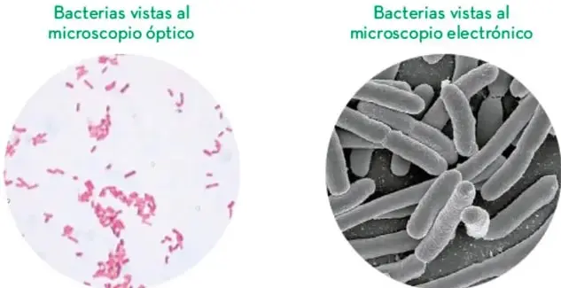 Células semejantes con colorante, se distingue claramente el núcleo como estructura redonda y oscura.