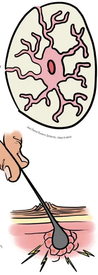 Ilustración de una célula ósea con forma de estrella y prolongaciones, con núcleo visible en el centro.