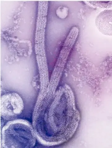 Microfotografía de color morado/violeta que muestra estructuras microscópicas alargadas y curvadas, posiblemente microorganismos o esporas, sobre un fondo claro teñido.