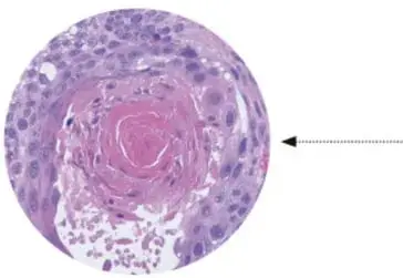 Micrografía de células vegetales con cloroplastos verdes.