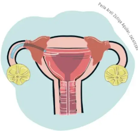 Ilustración de una maqueta del aparato reproductor femenino con botellas y mangueras.