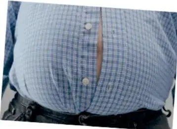 Fotografía de una persona con sobrepeso, vistiendo camisa a cuadros azul, mostrando el abdomen prominente.