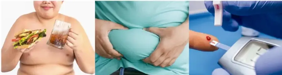 Tres fotografías: un niño con comida chatarra y bebida azucarada, una persona con sobrepeso midiendo su cintura, y una prueba de glucosa con tiras reactivas.