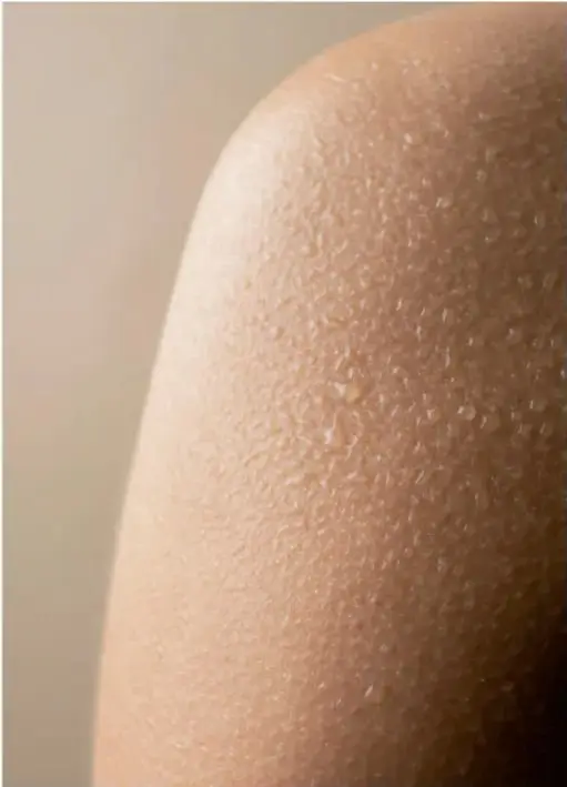 Fotografía de primer plano de piel humana con gotas de agua (sudor) sobre ella.