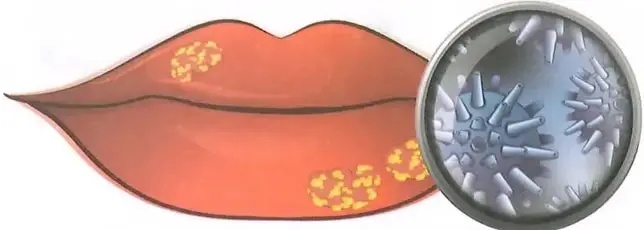 Figura 2 de Ciencias Naturales 10° · 2025