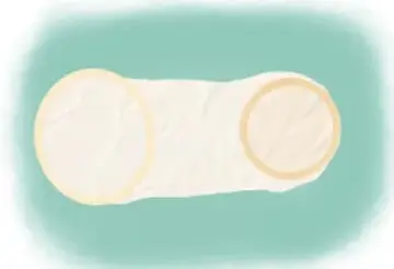 Ilustración de un condón femenino (funda con anillos en ambos extremos).