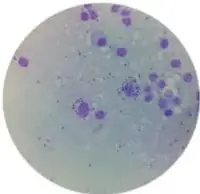 Microfotografía circular de macrófagos teñidos de morado sobre fondo claro.