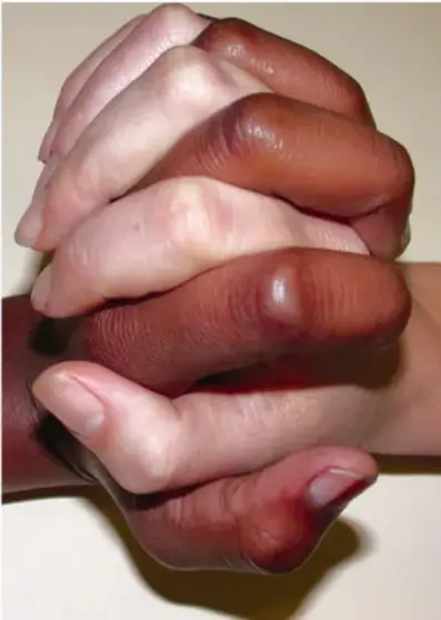 Fotografía de dos manos entrelazadas con fuerza, una de piel clara y otra de piel oscura, que simboliza el acuerdo, la unión y la resolución pacífica de conflictos.