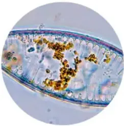 Micrografía de un microorganismo (posiblemente un protozoo) con estructuras internas visibles.