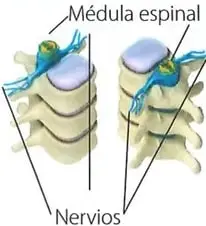 Ilustración de la médula espinal dentro de la columna vertebral y de los nervios que salen de ella.
