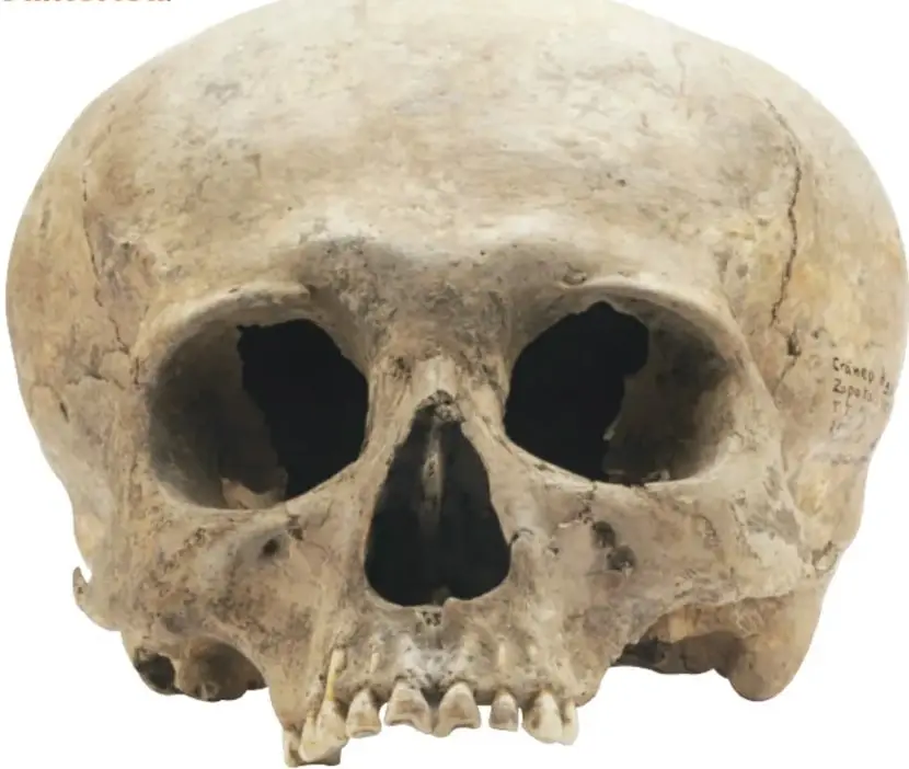 Fotografía frontal de gran tamaño de un cráneo humano prehispánico con deformación craneal, con dientes limados visibles y ligera escritura de inventario en el lado derecho.