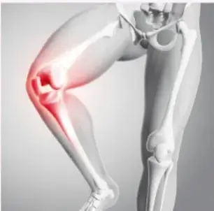 Ilustración de una rodilla humana con la zona articular resaltada en rojo, mostrando una articulación en flexión