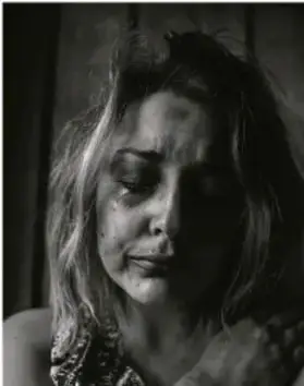 Fotografía en blanco y negro de una joven con expresión triste, ilustrando los sentimientos de inseguridad y baja autoestima asociados a la hipersexualización.