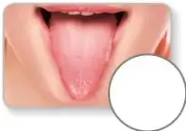 Fotografía de una boca abierta mostrando la lengua con un círculo blanco para marcar.