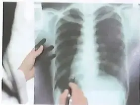 Figura 2 de Ciencias Naturales 10° · 2025