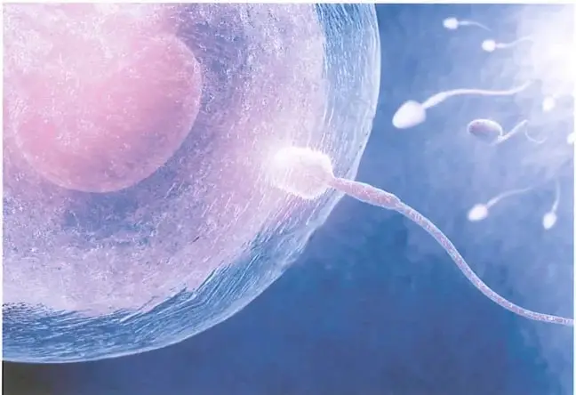 Figura 2 de Ciencias Naturales 9° · 2025