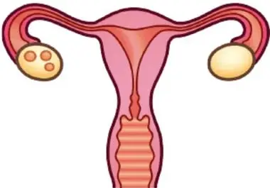 Esquema del sistema reproductivo femenino: ovarios, trompas de Falopio, útero, cuello uterino y vagina.