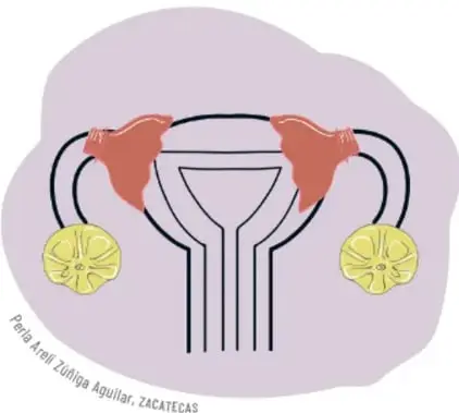 Maqueta del aparato reproductor femenino con botellas y mangueras.