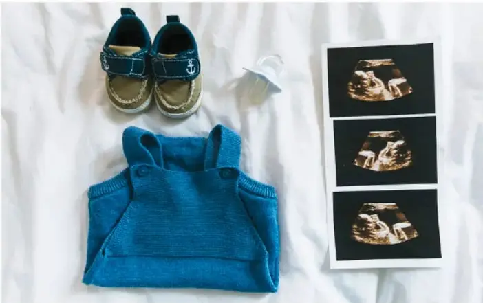 Fotografía sobre tela blanca con ropa y calzado de bebé: zapatitos azules, suéter tejido azul, chupón y tres imágenes de ultrasonido fetal.