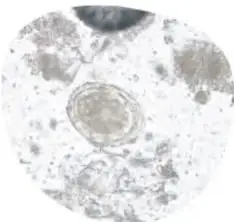 Microfotografía en blanco y negro de un parásito intestinal (célula u organismo microscópico) sobre fondo claro.