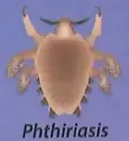 Ilustración de un piojo asociada con la phthiriasis, dentro de las enfermedades parasitarias.