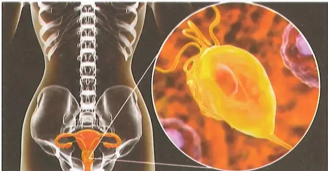 Figura 3 de Ciencias Naturales 9° · 2025