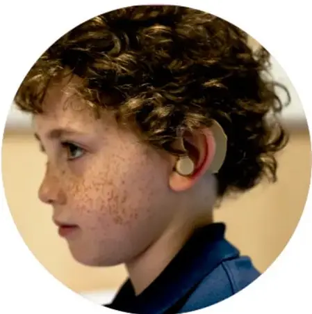 Fotografía de un niño de perfil con cabello rizado y pecas, usando un audífono retroauricular en su oreja derecha.