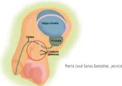 Símbolo de prohibición rojo sobre espermatozoides, representando la anticoncepción o antifecundación.