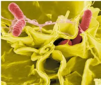 Imagen de microscopía electrónica de patógenos (bacterias en rojo/rosa) sobre células amarillas.